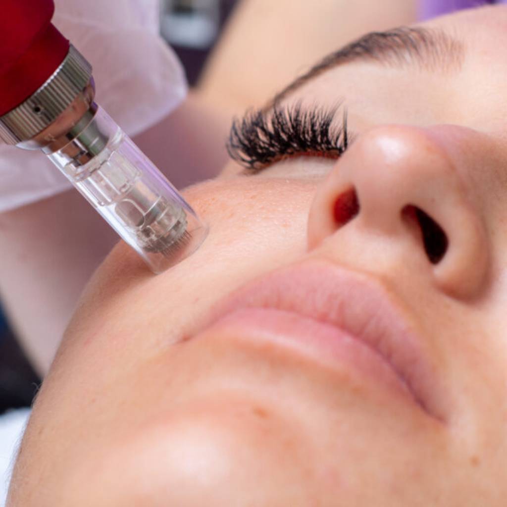 Microneedling Advanced Training Online